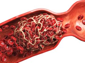 Darah Manis: Memahami Makna, Mitos, dan Fakta Medis yang Perlu Kamu Tahu